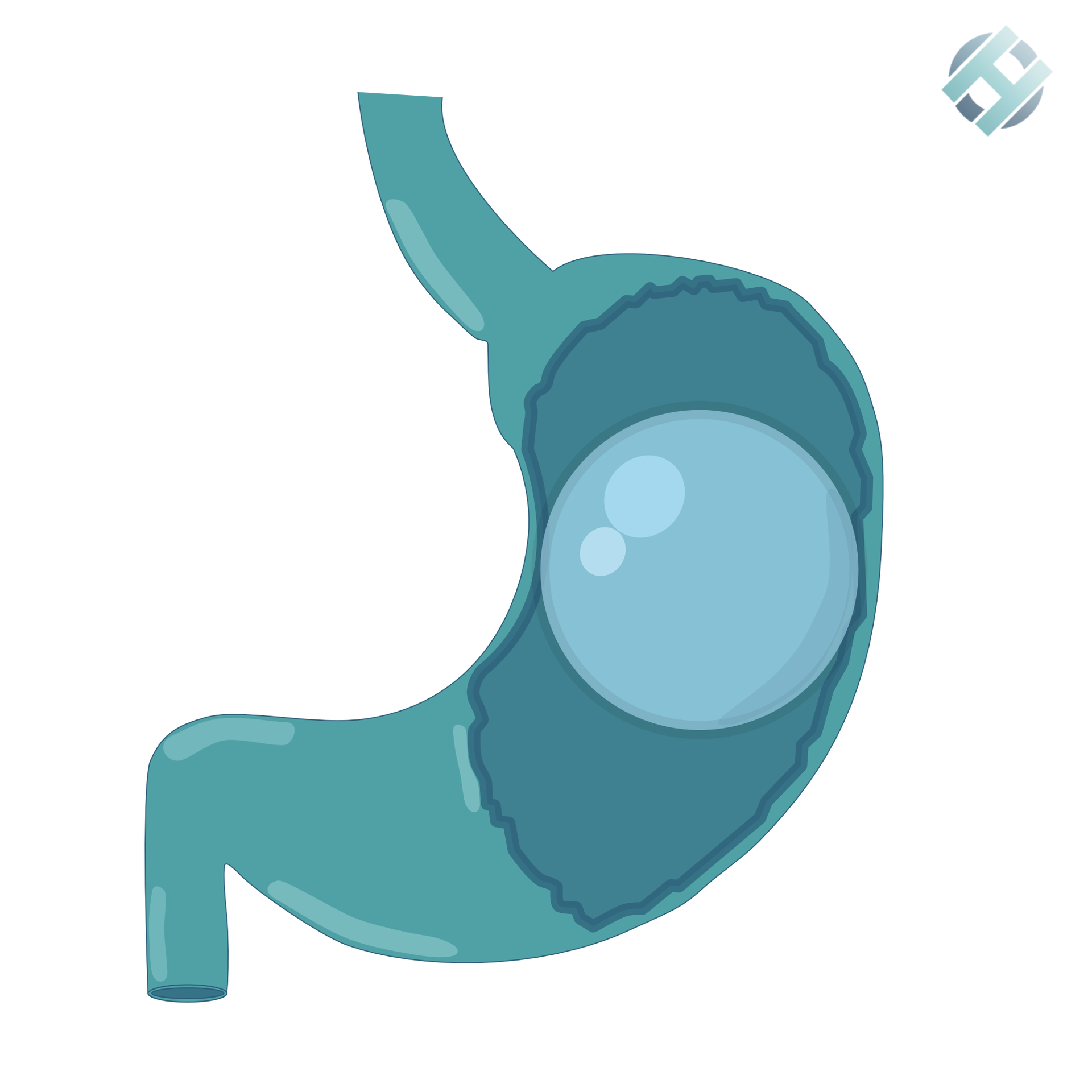Balón gástrico